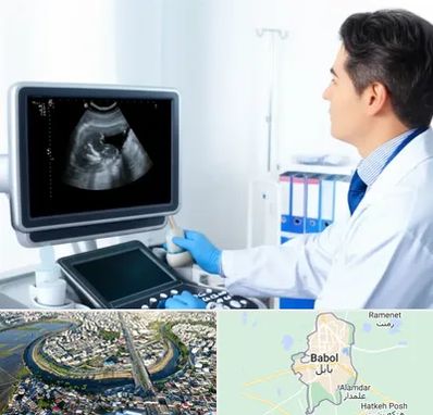 دکتر فوق تخصص پروستات در بابل