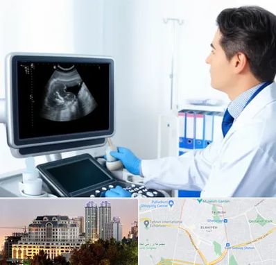 دکتر فوق تخصص پروستات در فرشته 