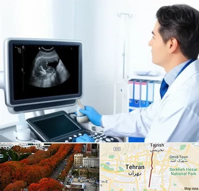 دکتر فوق تخصص پروستات در ولیعصر 