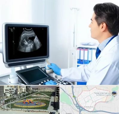 دکتر فوق تخصص پروستات در مرزداران تبریز 