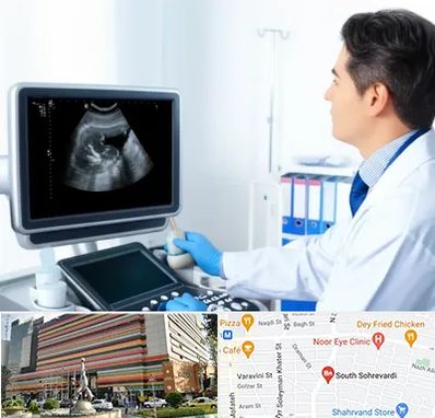 دکتر فوق تخصص پروستات در سهروردی 