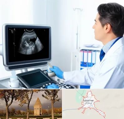 دکتر فوق تخصص پروستات در تویسرکان