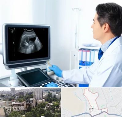 دکتر فوق تخصص پروستات در اوین 