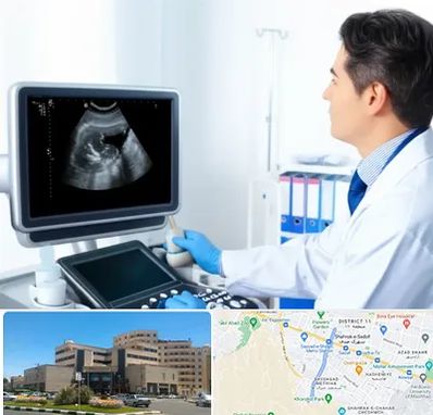 دکتر فوق تخصص پروستات در صیاد شیرازی مشهد 