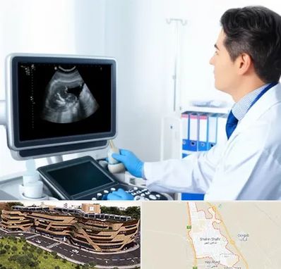 دکتر فوق تخصص پروستات در شاهین شهر