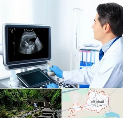 دکتر فوق تخصص پروستات در علی‌ آباد کتول