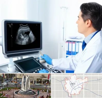 دکتر فوق تخصص پروستات در زابل