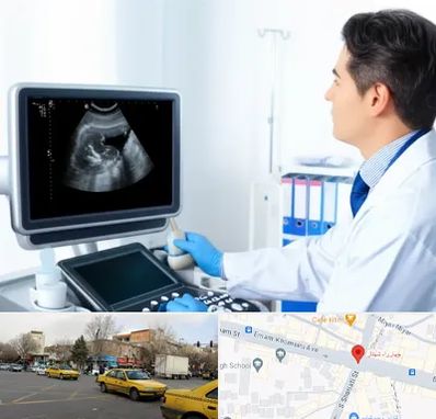 دکتر فوق تخصص پروستات در شهناز تبریز 