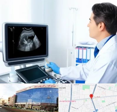 دکتر فوق تخصص پروستات در نصف راه تبریز 