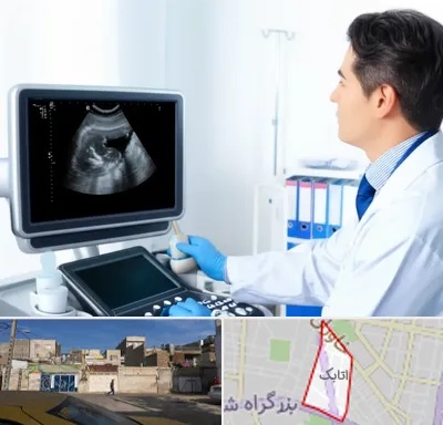 دکتر فوق تخصص پروستات در اتابک