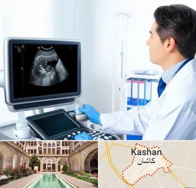 دکتر فوق تخصص پروستات در کاشان