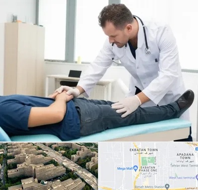 دکتر متخصص واریکوسل در اکباتان 