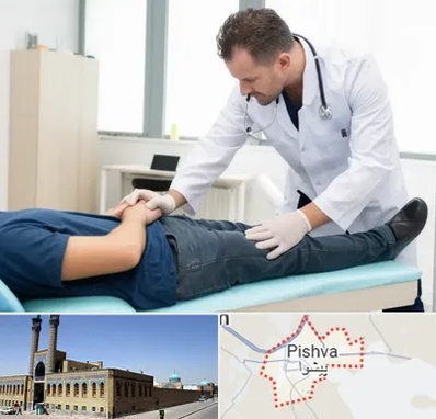 دکتر متخصص واریکوسل در پیشوا
