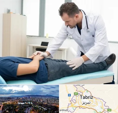 دکتر متخصص واریکوسل در تبریز