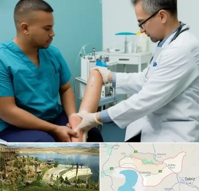 کلینیک زخم در شبستر