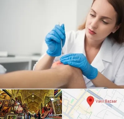 متخصص زخم در بازار وکیل شیراز
