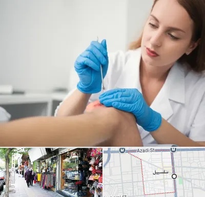 متخصص زخم در سلسبیل