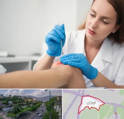 متخصص زخم در لویزان