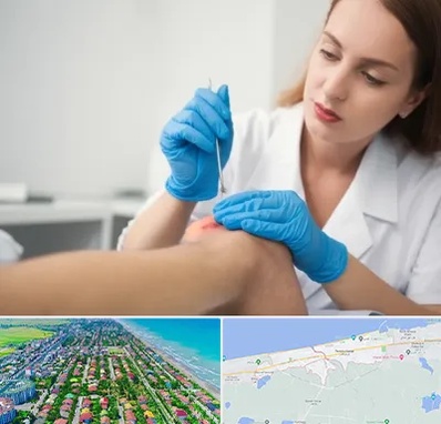 متخصص زخم در فریدونکنار