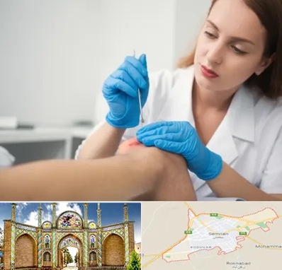 متخصص زخم در سمنان