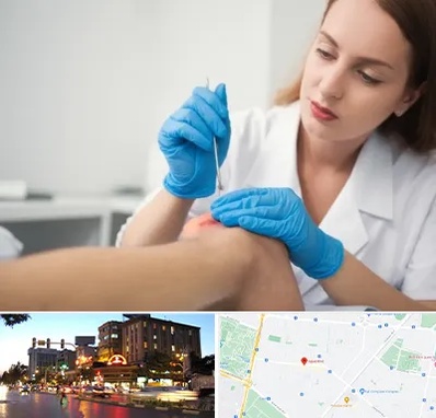 متخصص زخم در بلوار سجاد مشهد 