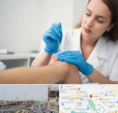 متخصص زخم در بلوار توس مشهد 