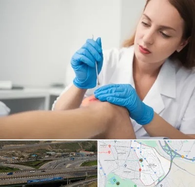 متخصص زخم در یاغچیان تبریز 