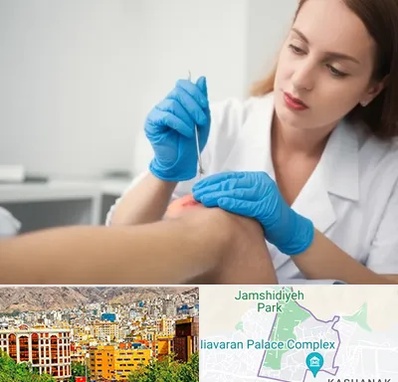 متخصص زخم در نیاوران 