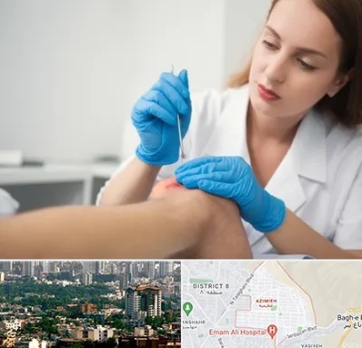 متخصص زخم در عظیمیه کرج 