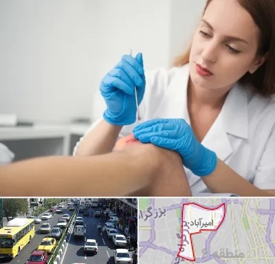 متخصص زخم در امیرآباد
