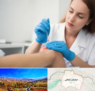 متخصص زخم در خراسان شمالی