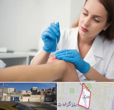 متخصص زخم در اتابک