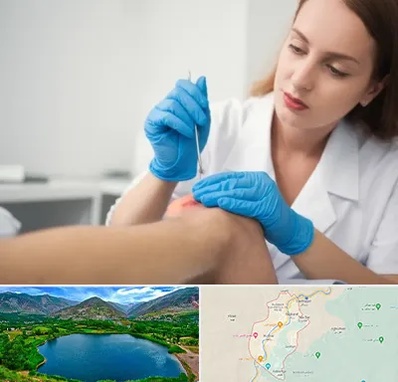 متخصص زخم در رودبار