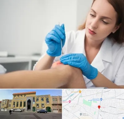 متخصص زخم در زنبیل آباد قم 