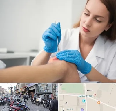متخصص زخم در چهارراه استانبول