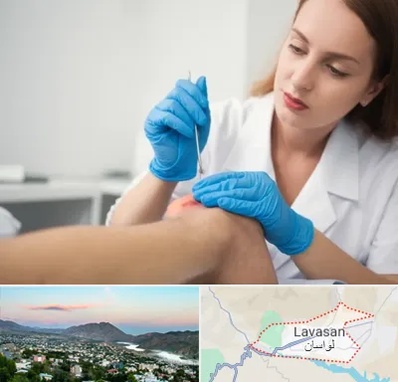متخصص زخم در لواسان