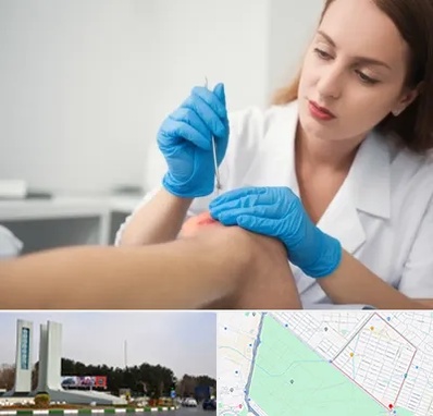 متخصص زخم در بلوار فلسیطین مشهد 