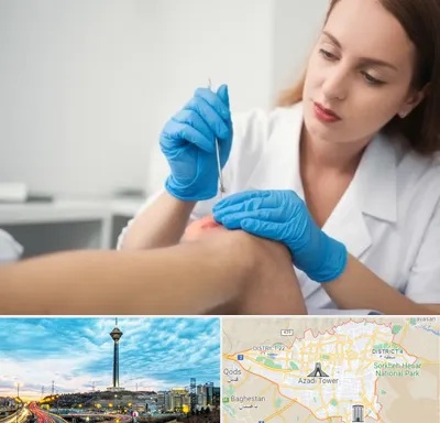 متخصص زخم در تهران