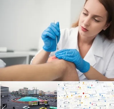متخصص زخم در میدان انقلاب