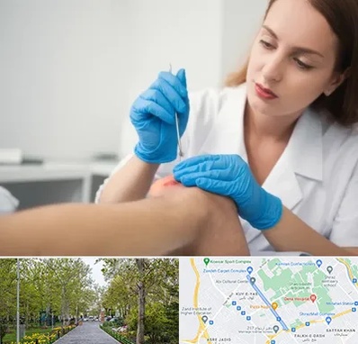 متخصص زخم در قدوسی غربی شیراز 