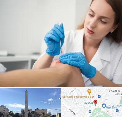 متخصص زخم در فلکه گاز شیراز 