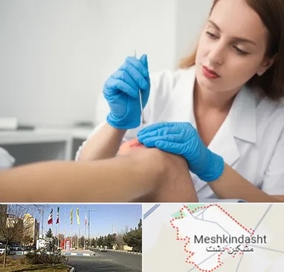 متخصص زخم در مشکین دشت