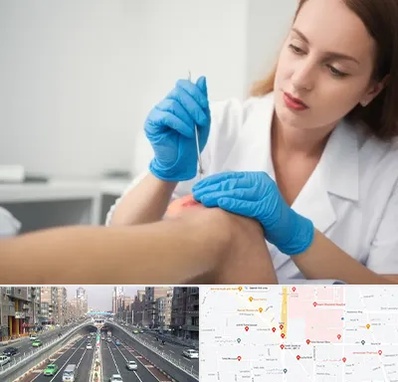 متخصص زخم در توحید