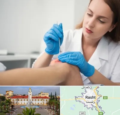 متخصص زخم در رشت