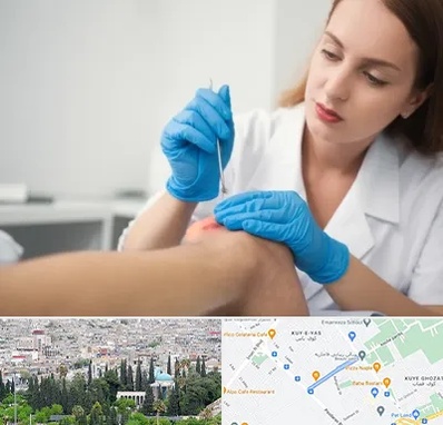 متخصص زخم در محلاتی شیراز 