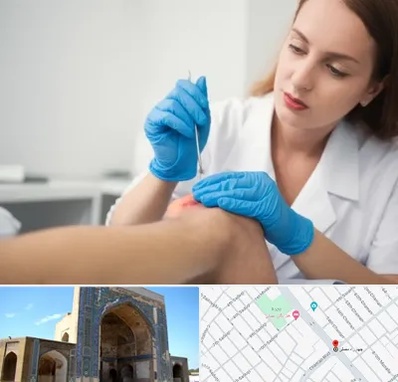 متخصص زخم در مصلی مشهد 