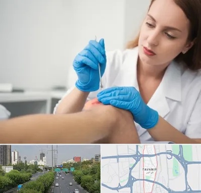 متخصص زخم در توانیر 