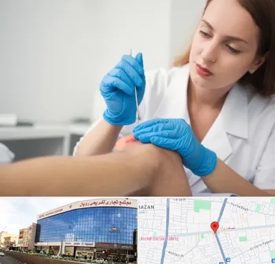 متخصص زخم در نصف راه تبریز 