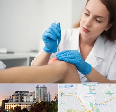 متخصص زخم در فرشته 