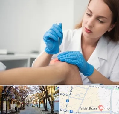 متخصص زخم در تربیت تبریز 